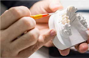 国内技工士との連携で、高品質で美しい審美治療。