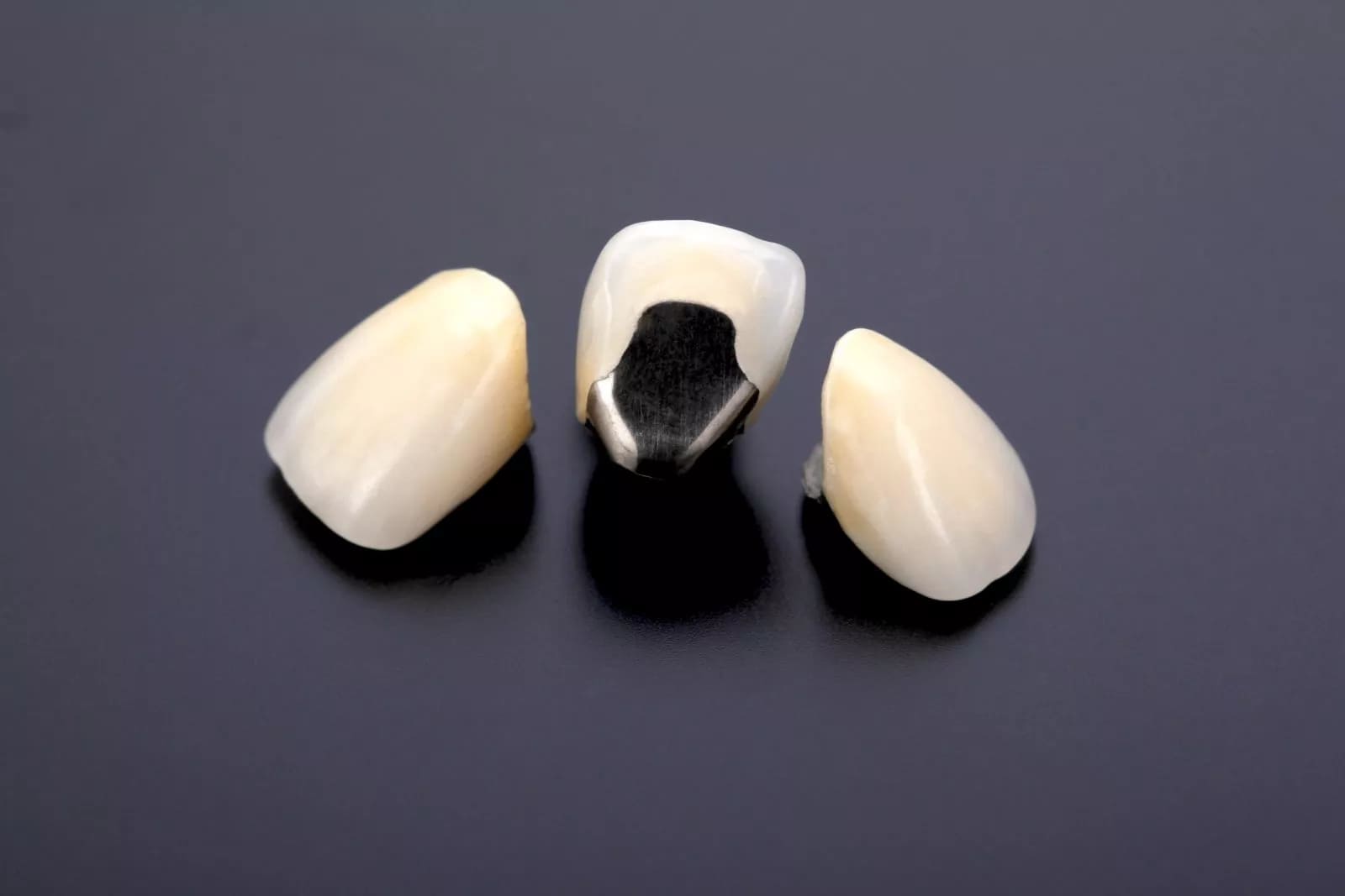 メタルセラミッククラウン