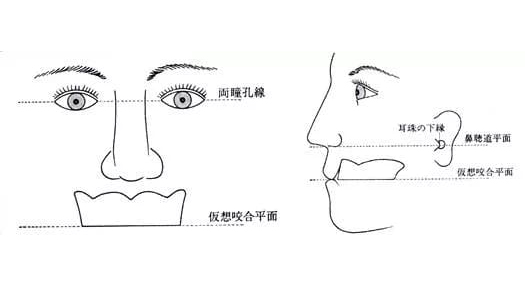 虫歯感染部位がピンポイントでわかる「う蝕検知液」の写真