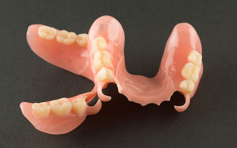 若い人も愛用の「審美」入れ歯