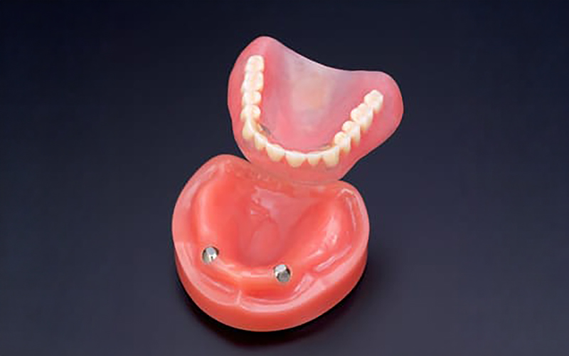 自分の歯のように咬みやすい入れ歯