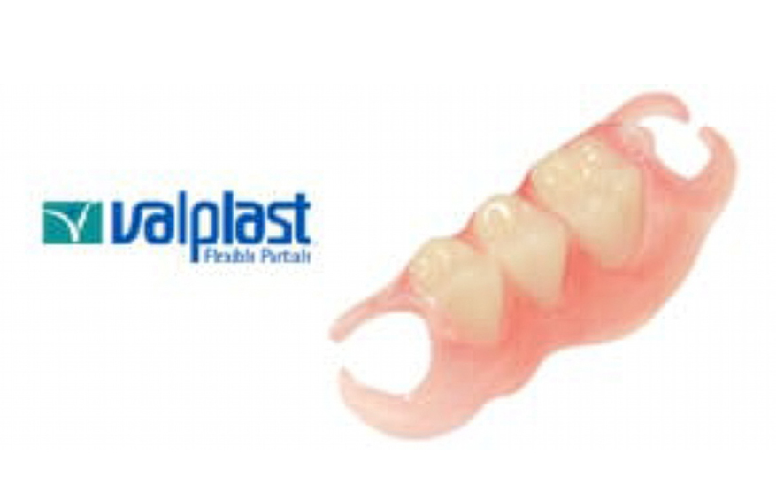 スマイルデンチャー