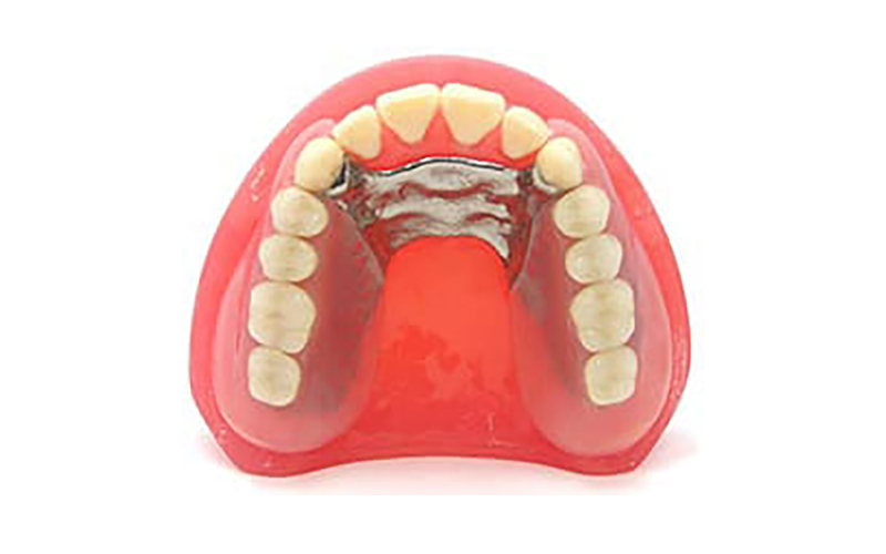 スマイルデンチャー