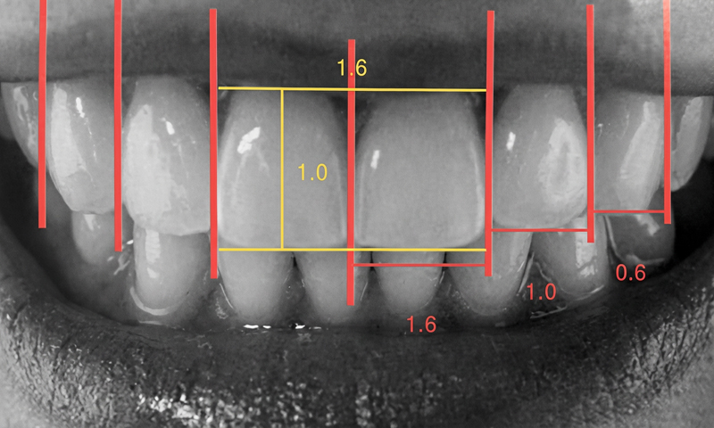 前歯の並びに存在する”黄金比”