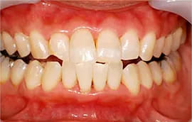 完成形をイメージする「シミュレーション」