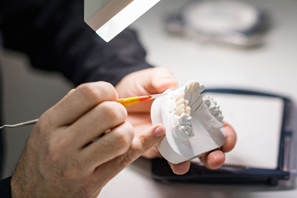 「審美セラミック治療の匠」歯科技工士