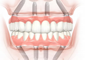 治療器具を滅菌する「オートクレーブ滅菌器」