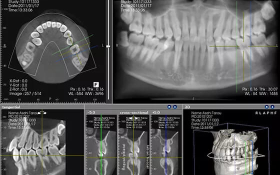 CT／レントゲン検査