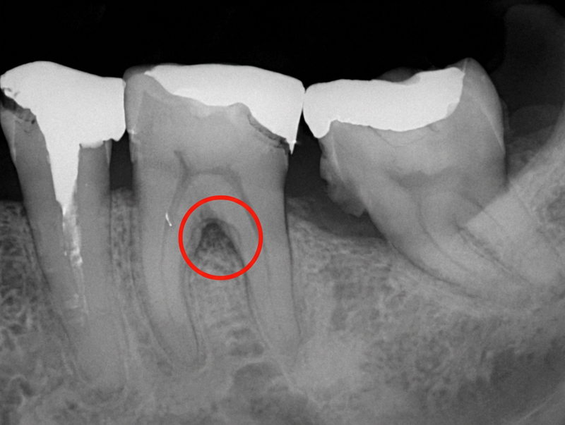 ルートセパレーション