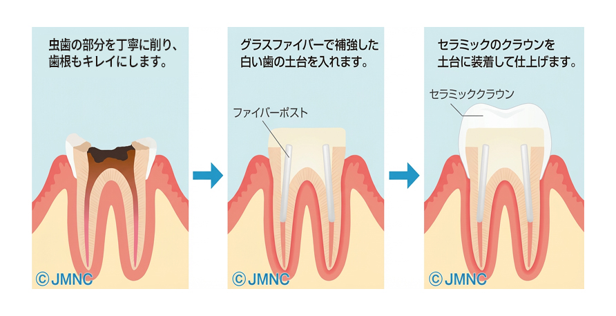 樹脂素材でつくられたファイバーコア