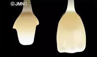 ファイバーコア