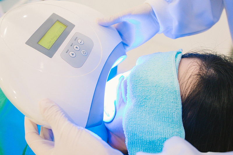 オフィスホワイトニング